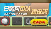 广西有治疗白癜风的医院 广西有治疗白癜风的医院