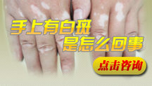 西安治白癜风的最快医院 西安治白癜风的最快医院