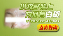 新疆医院哪家治白癜风好 新疆医院哪家治白癜风好